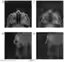Fig. 07 - MAGNETIC RESONANCE IMAGING METHOD AND DEVICE