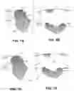 Fig. 09 - BODY STRUCTURE IMAGING