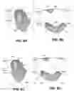 Fig. 10 - BODY STRUCTURE IMAGING