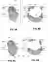 Fig. 11 - BODY STRUCTURE IMAGING