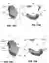 Fig. 12 - BODY STRUCTURE IMAGING