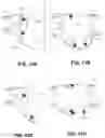 Fig. 13 - BODY STRUCTURE IMAGING