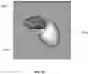Fig. 15 - BODY STRUCTURE IMAGING
