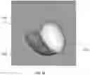 Fig. 16 - BODY STRUCTURE IMAGING