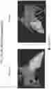 Fig. 18 - BODY STRUCTURE IMAGING