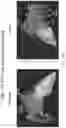 Fig. 20 - BODY STRUCTURE IMAGING