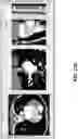 Fig. 29 - BODY STRUCTURE IMAGING