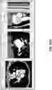 Fig. 31 - BODY STRUCTURE IMAGING