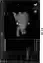 Fig. 36 - BODY STRUCTURE IMAGING