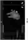 Fig. 41 - BODY STRUCTURE IMAGING