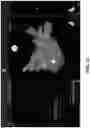 Fig. 42 - BODY STRUCTURE IMAGING