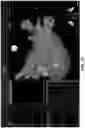 Fig. 44 - BODY STRUCTURE IMAGING