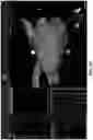 Fig. 52 - BODY STRUCTURE IMAGING