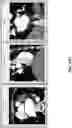 Fig. 55 - BODY STRUCTURE IMAGING