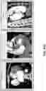 Fig. 56 - BODY STRUCTURE IMAGING