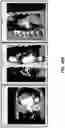 Fig. 59 - BODY STRUCTURE IMAGING