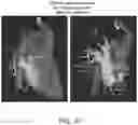 Fig. 61 - BODY STRUCTURE IMAGING