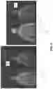 Fig. 07 - Sensor fusion for measurement of physiological parameters