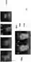 Fig. 08 - Sensor fusion for measurement of physiological parameters