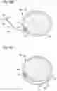 Fig. 21 - BLOOD PRESSURE MEASUREMENT CUFF AND METHOD FOR MANUFACTURING SAME