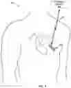 Fig. 02 - Electrocardiogram gain adjustment