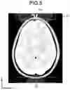 Fig. 06 - Magnetic resonance imaging apparatus, correction method, and memory medium
