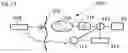Fig. 13 - Voice control system for an implant