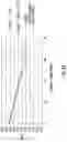 Fig. 03 - OPTICAL GLUCOMETER