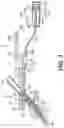 Fig. 05 - GLUCOSE BIOSENSORS COMPRISING DIRECT ELECTRON TRANSFER ENZYMES AND METHODS OF MAKING AND USING THEM
