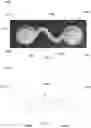 Fig. 11 - ELASTIC WEARABLE SENSOR