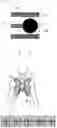 Fig. 03 - BIO-ELECTRODE COMPOSITION, BIO-ELECTRODE, AND METHOD FOR MANUFACTURING BIO-ELECTRODE