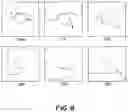 Fig. 10 - METHOD FOR LOW-VOLTAGE TERMINATION OF CARDIAC ARRHYTHMIAS BY EFFECTIVELY UNPINNING ANATOMICAL REENTRIES