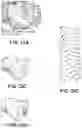 Fig. 18 - METHOD FOR LOW-VOLTAGE TERMINATION OF CARDIAC ARRHYTHMIAS BY EFFECTIVELY UNPINNING ANATOMICAL REENTRIES