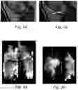 Fig. 02 - METHOD AND SYSTEM FOR VISUALIZING A PROPERTY OF CARTILAGE