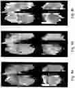 Fig. 04 - METHOD AND SYSTEM FOR VISUALIZING A PROPERTY OF CARTILAGE