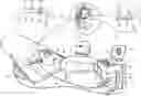 Fig. 01 - IDENTIFICATION AND VISUALIZATION OF NON-NAVIGATED OBJECTS IN MEDICAL IMAGES