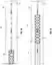 Fig. 07 - Guidewire for imaging and measurement of pressure and other physiologic parameters