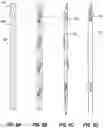 Fig. 11 - Guidewire for imaging and measurement of pressure and other physiologic parameters