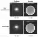 Fig. 07 - SYSTEM AND METHOD FOR REDUCTING OR ELIMINATING ARTIFACTS IN MAGNECTIC RESONANCE IMAGING