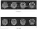 Fig. 08 - SYSTEM AND METHOD FOR REDUCTING OR ELIMINATING ARTIFACTS IN MAGNECTIC RESONANCE IMAGING