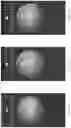 Fig. 68 - Systems and methods for autocorrelation based assessment of PPG signal quality
