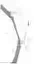 Fig. 11 - SPECT-scanner and collimator