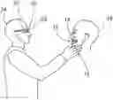 Fig. 01 - Apparatus for real-time visualizing a movement of a lower jaw versus an upper jaw in a craniomaxillofacial area of a patient in dental diagnostics