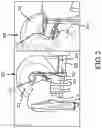 Fig. 04 - Computer tomography apparatus