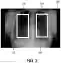 Fig. 03 - System, method and computer program for acquiring phase imaging data of an object