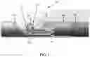 Fig. 02 - ULTRASOUND TRANSDUCER ASSEMBLY, PROBE, ENDOSCOPY SYSTEM AND MANUFACTURING METHOD