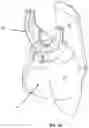 Fig. 33 - ACCESSORY TECHNOLOGIES FOR ULTRASOUND SYSTEMS