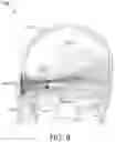 Fig. 09 - Adaptive pulsing for sonothrombolysis treatment