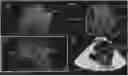 Fig. 01 - Methods and systems for segmentation and rendering of inverted data