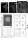 Fig. 14 - METHOD AND LOCAL AND REGIONAL CLOUD INFRASTRUCTURE SYSTEM FOR PRESSURE ELASTOGRAPHY MEASUREMENT DEVICES
